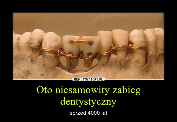 Oto niesamowity zabieg dentystyczny – sprzed 4000 lat 