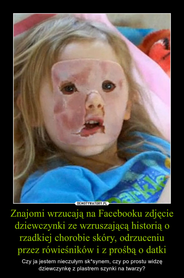 Znajomi wrzucają na Facebooku zdjęcie dziewczynki ze wzruszającą historią o rzadkiej chorobie skóry, odrzuceniu przez rówieśników i z prośbą o datki