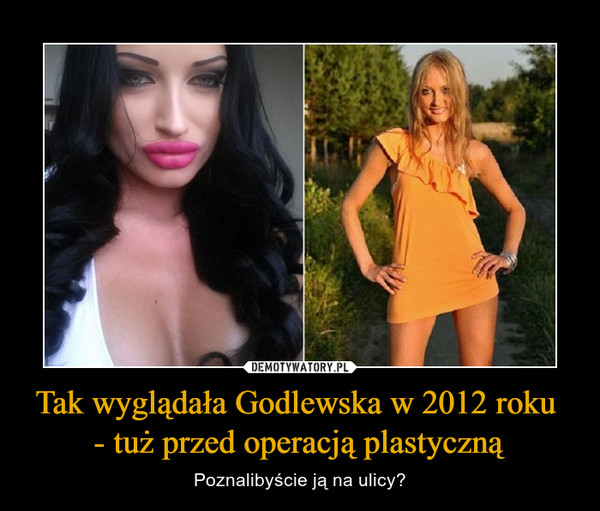 Tak wyglądała Godlewska w 2012 roku - tuż przed operacją plastyczną – Poznalibyście ją na ulicy? 