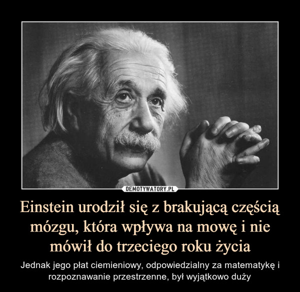 Einstein urodził się z brakującą częścią mózgu, która wpływa na mowę i nie mówił do trzeciego roku życia – Jednak jego płat ciemieniowy, odpowiedzialny za matematykę i rozpoznawanie przestrzenne, był wyjątkowo duży 