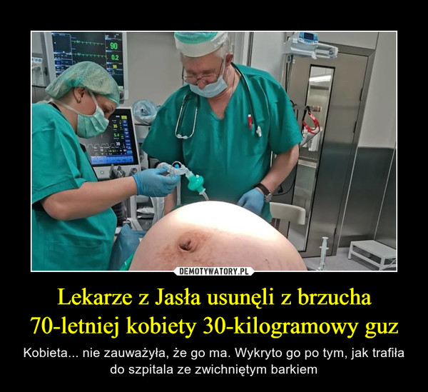 Lekarze z Jasła usunęli z brzucha 70-letniej kobiety 30-kilogramowy guz