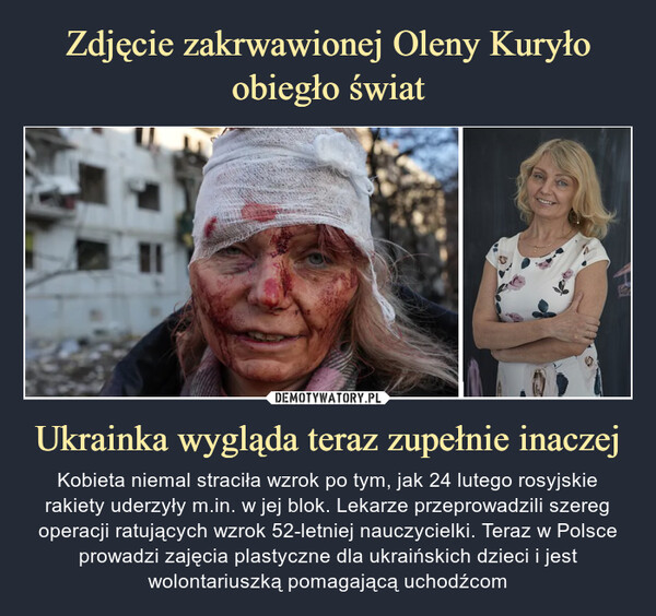 Ukrainka wygląda teraz zupełnie inaczej – Kobieta niemal straciła wzrok po tym, jak 24 lutego rosyjskie rakiety uderzyły m.in. w jej blok. Lekarze przeprowadzili szereg operacji ratujących wzrok 52-letniej nauczycielki. Teraz w Polsce prowadzi zajęcia plastyczne dla ukraińskich dzieci i jest wolontariuszką pomagającą uchodźcom 